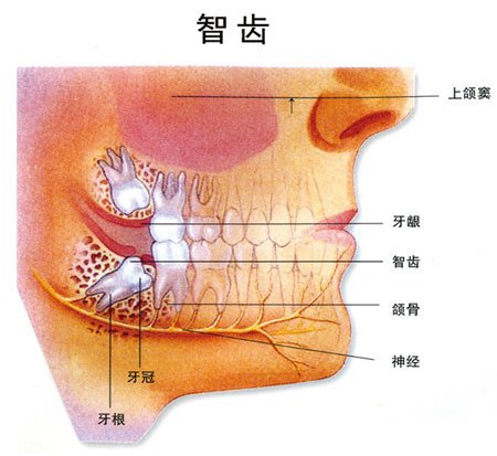 长智齿不舒服脸肿怎么办