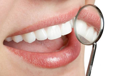牙齿黄洗牙能变白吗