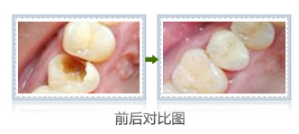 补牙去哪家医院好